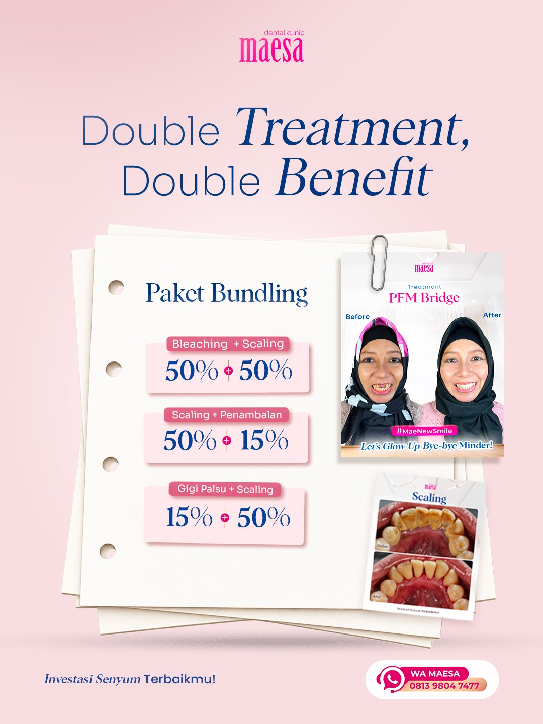 PROMO Maesa Dental Clinic | Klinik Gigi Terbaik - Double Treatment, Double Benefit!
