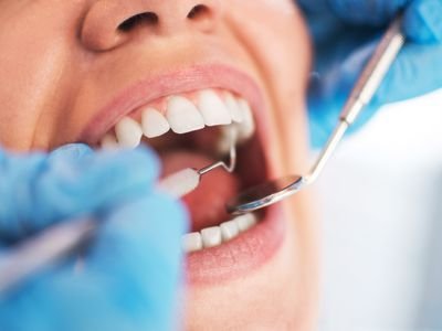 NEWS Maesa Dental Clinic | Klinik Gigi Terbaik - Makan Daging Saat Idul Adha? Jangan Lupa Jaga Kesehatan Gigi dan Mulut Kamu