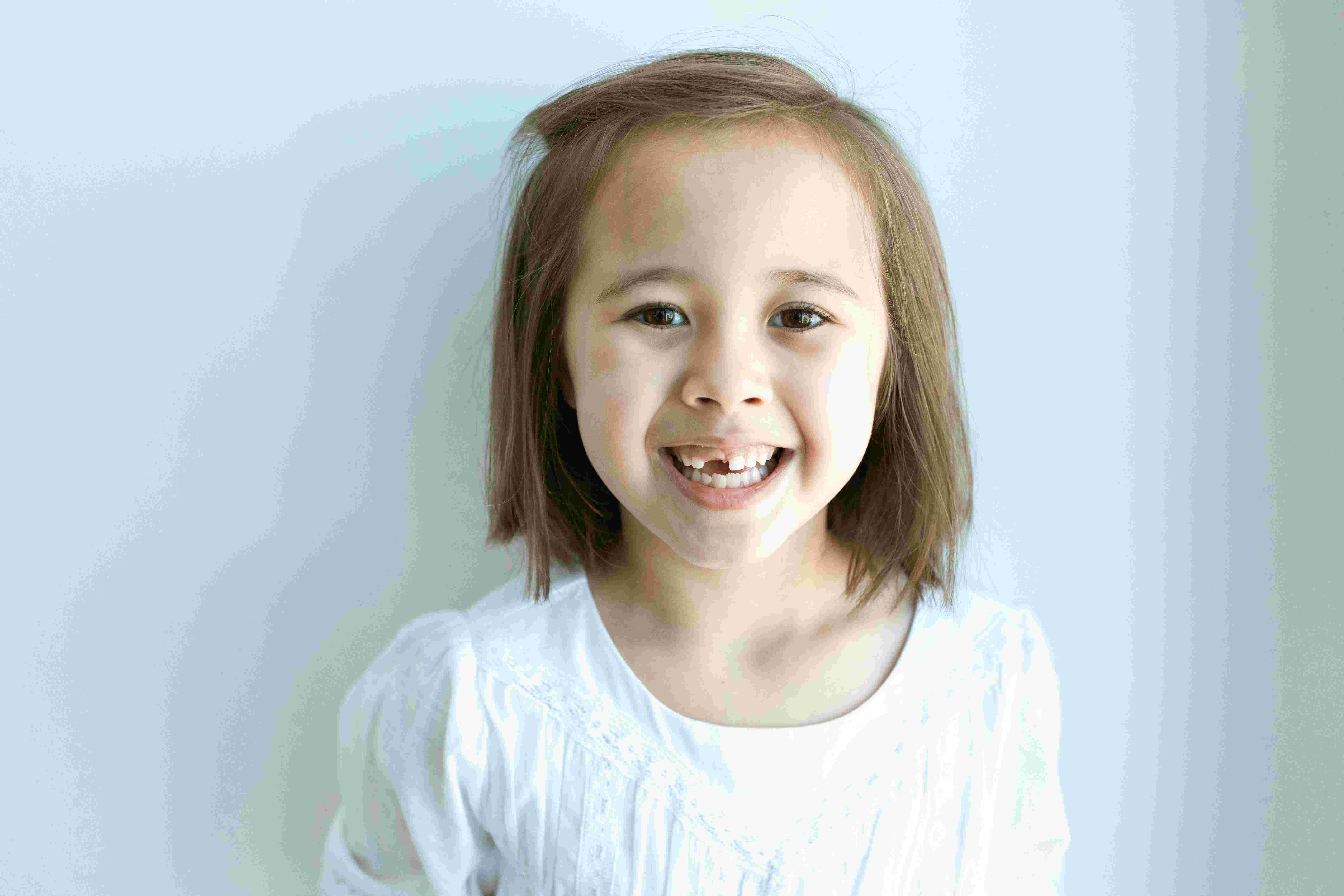 NEWS Maesa Dental Clinic | Klinik Gigi Terbaik - Gigi Susu Anak Mau Copot? Jangan Asal Cabut!