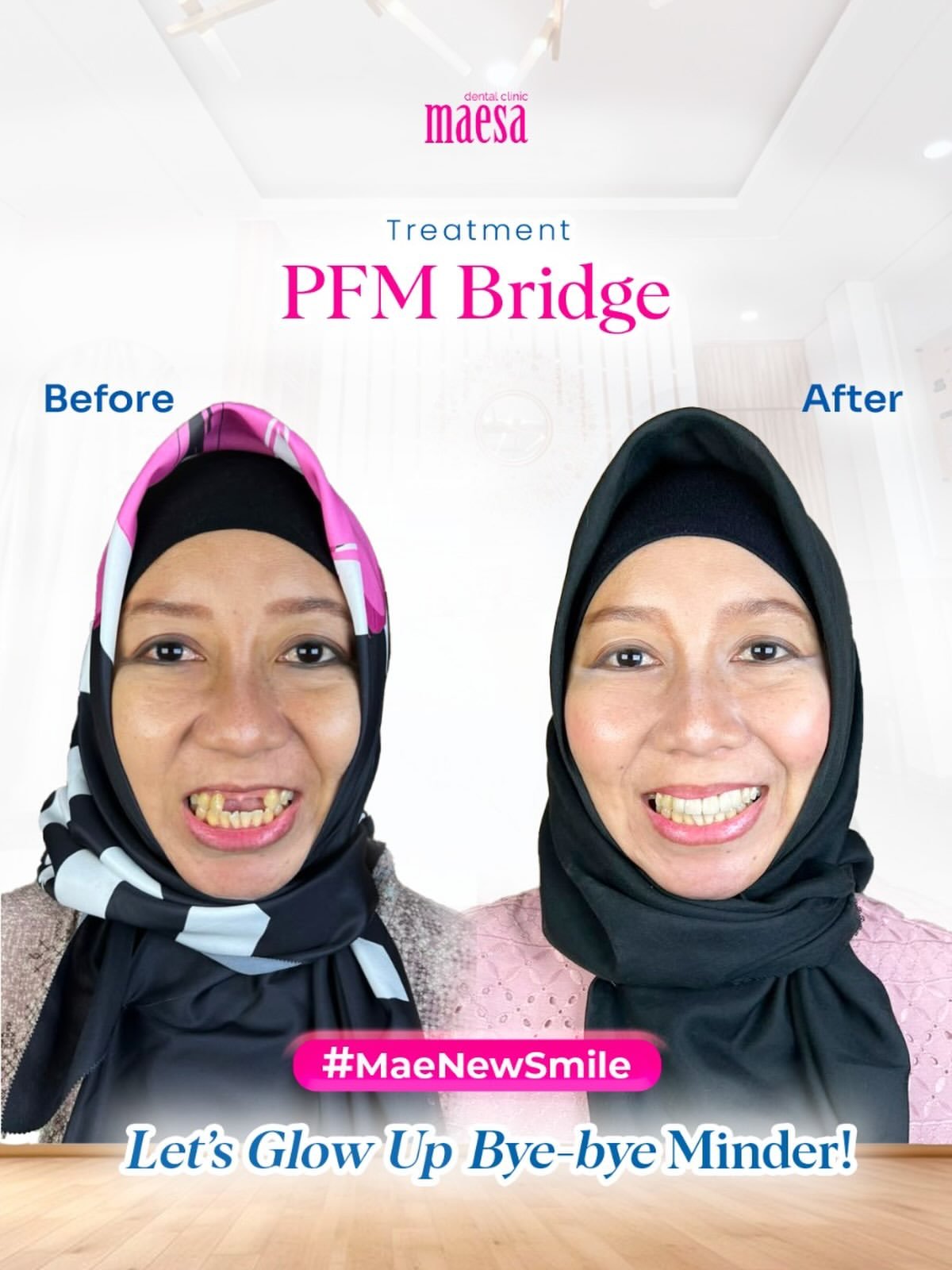 Instagram Maesa Dental Clinic | Klinik Gigi Terbaik