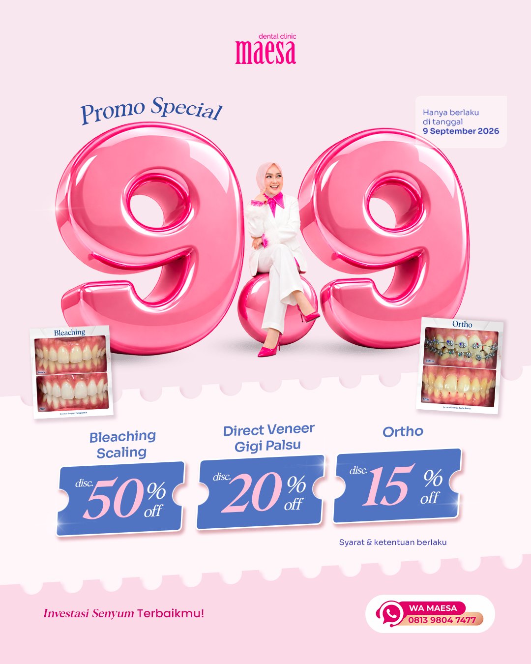 PROMO Maesa Dental Clinic | Klinik Gigi Terbaik - Promo Special 9.9