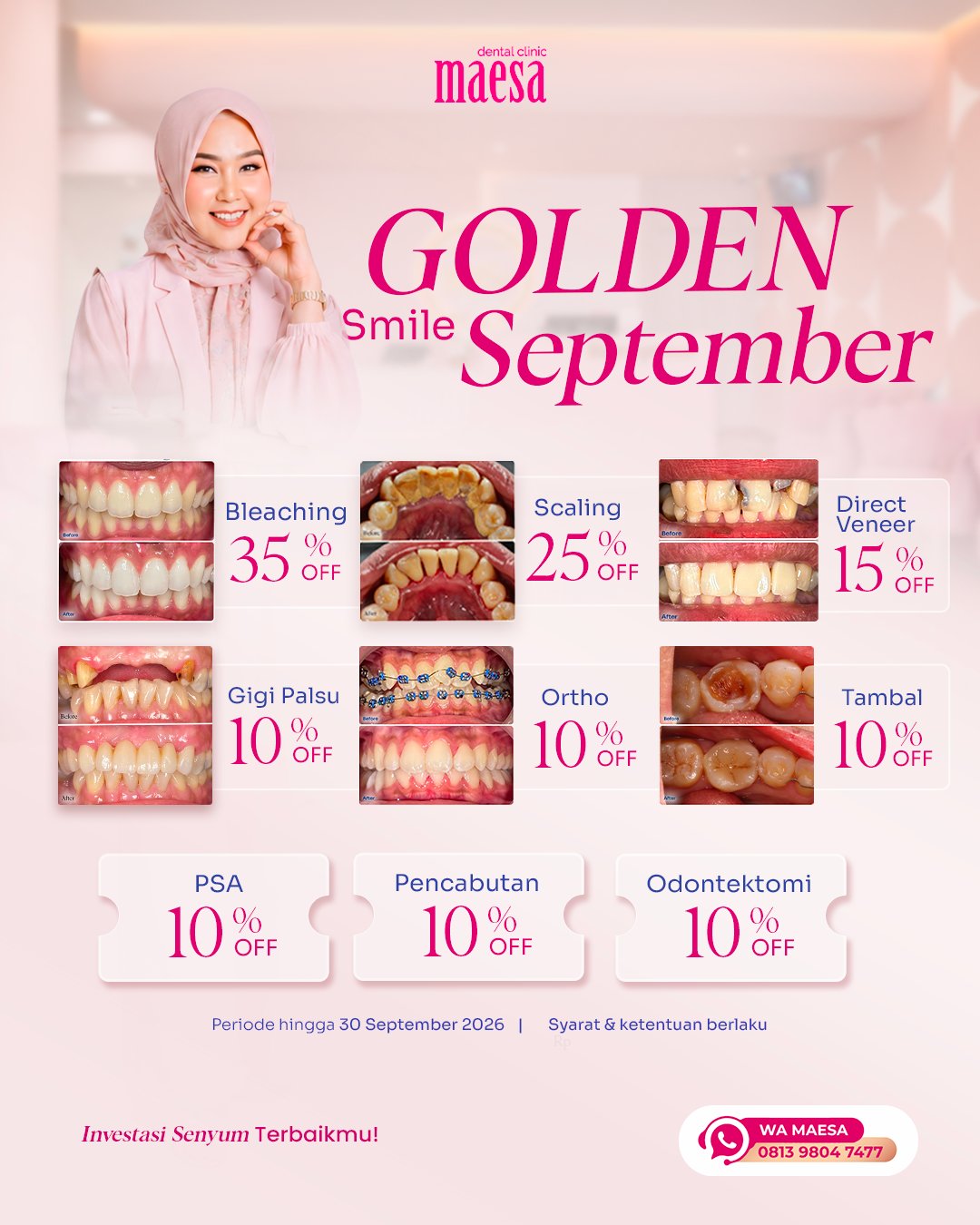 PROMO Maesa Dental Clinic | Klinik Gigi Terbaik - Golden Smile September