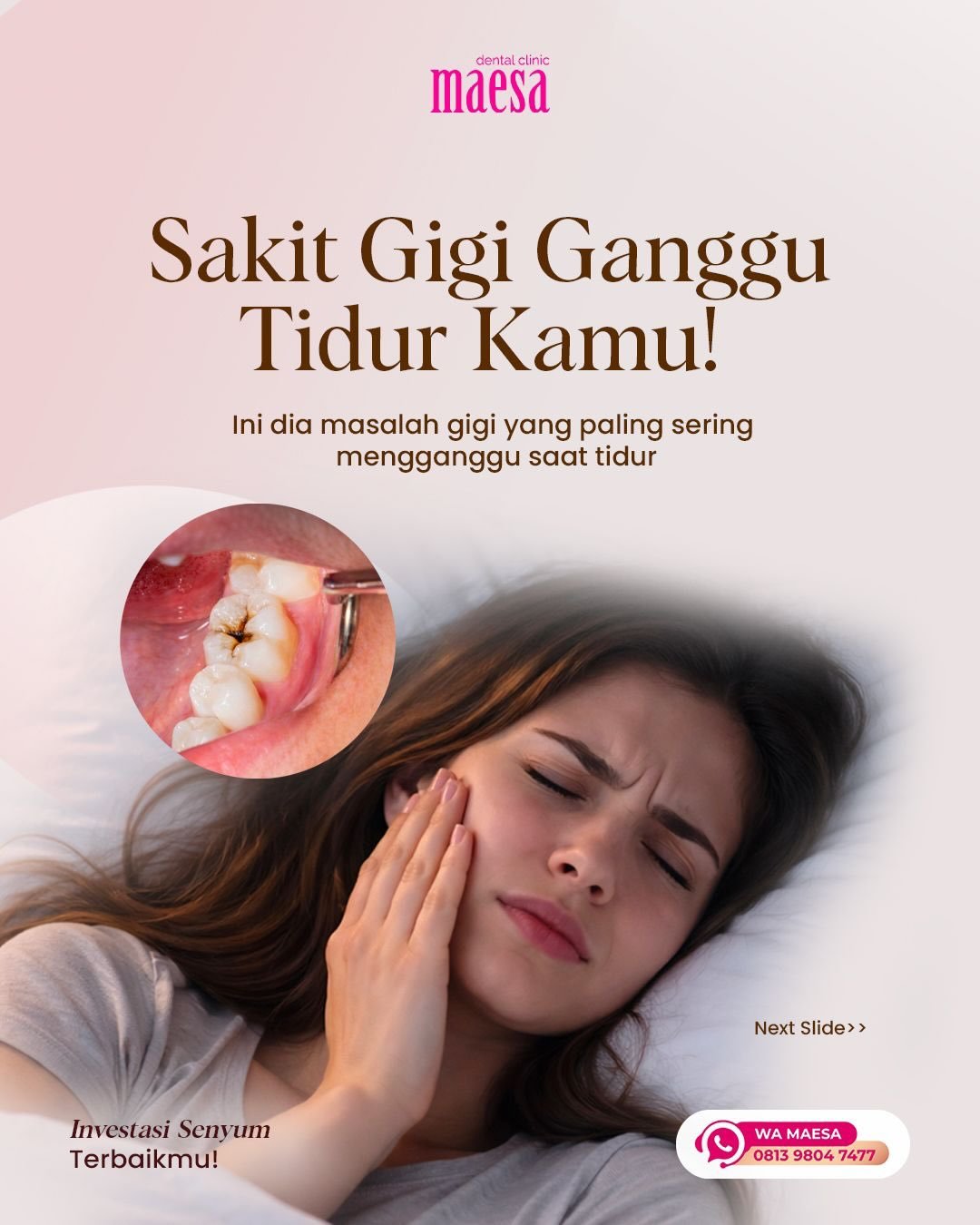 Instagram Maesa Dental Clinic | Klinik Gigi Terbaik