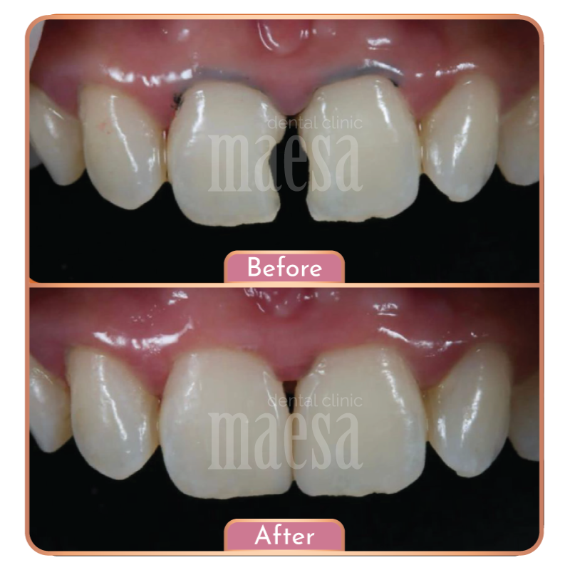 Maesa Dental Clinic