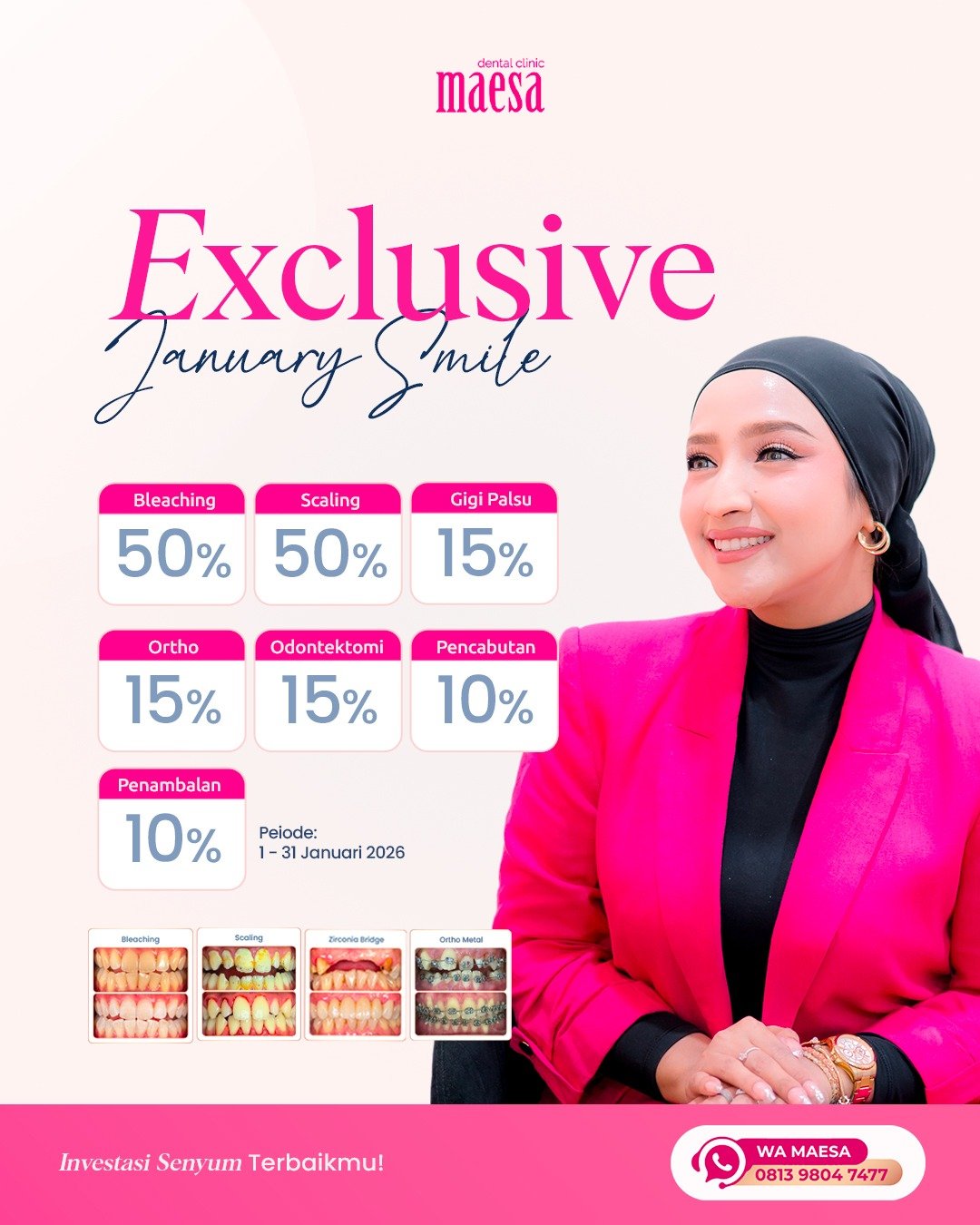 NEWS Maesa Dental Clinic | Klinik Gigi Terbaik - Exclusive January Smile