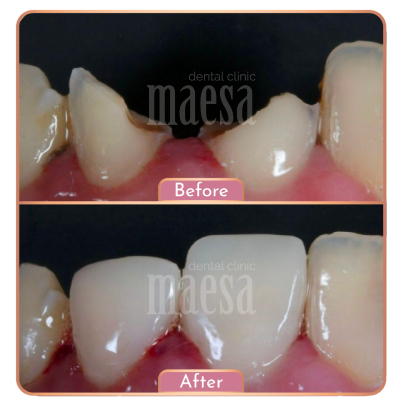 Maesa Dental Clinic